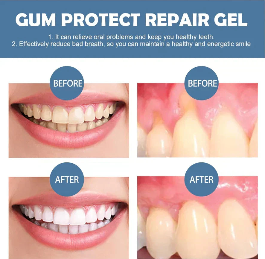 🦷50% OFF Limited Sale! Tidewisper® Gum Repair Gel for Receding Gums & Stained Teeth