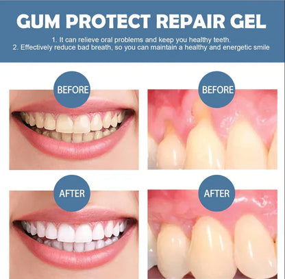 🦷50% OFF Limited Sale! Tidewisper® Gum Repair Gel for Receding Gums & Stained Teeth